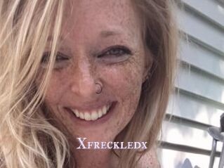Xfreckledx